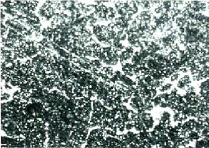 Tempered Martensite조직  (Cementite석출)